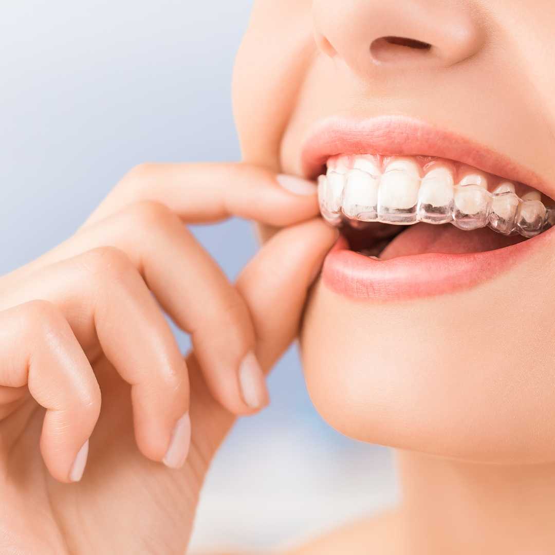 Cornerstone Family Dental dental clinic in Calgary - Photo 4