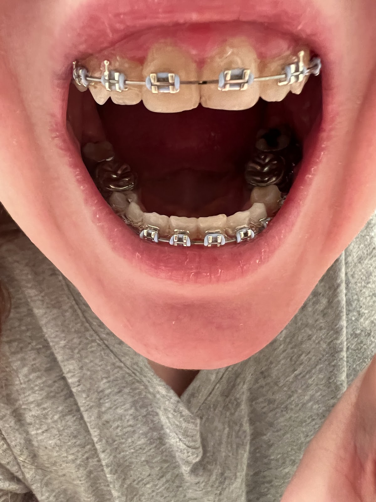 Maple Ridge Orthodontics dental clinic in Maple Ridge - Photo 3