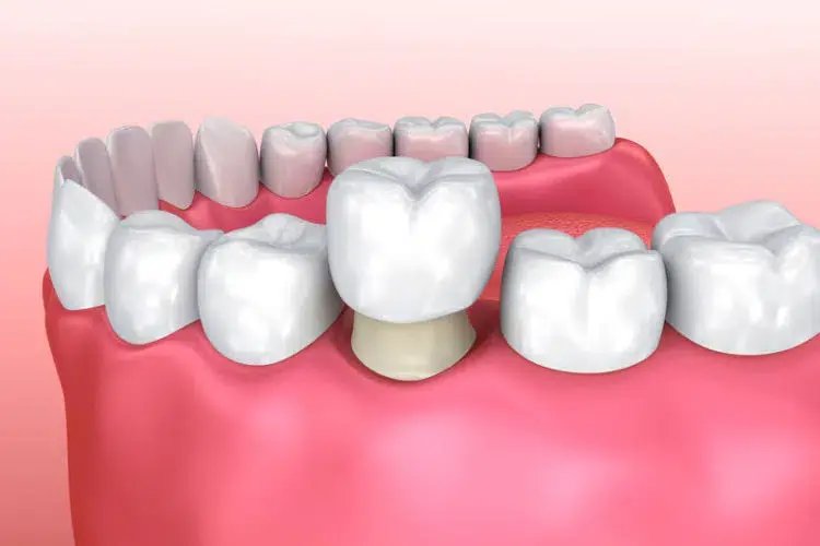 Rocky Ridge Dental dental clinic in Calgary - Photo 5