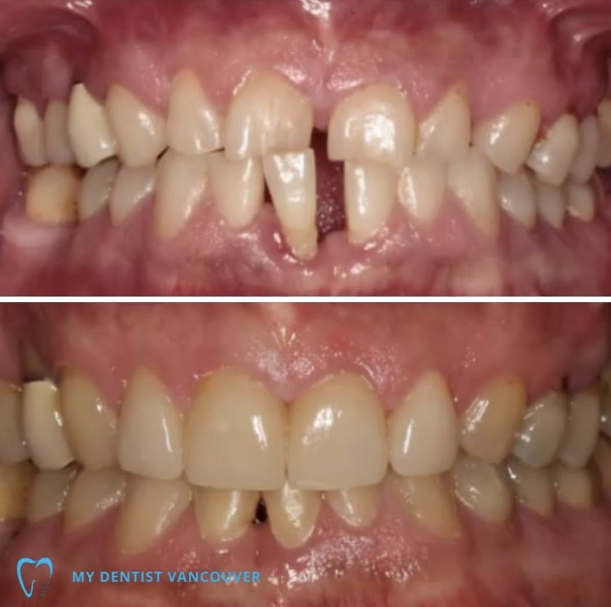 My Dentist Vancouver and Implant Centre dental clinic in Vancouver - Photo 2