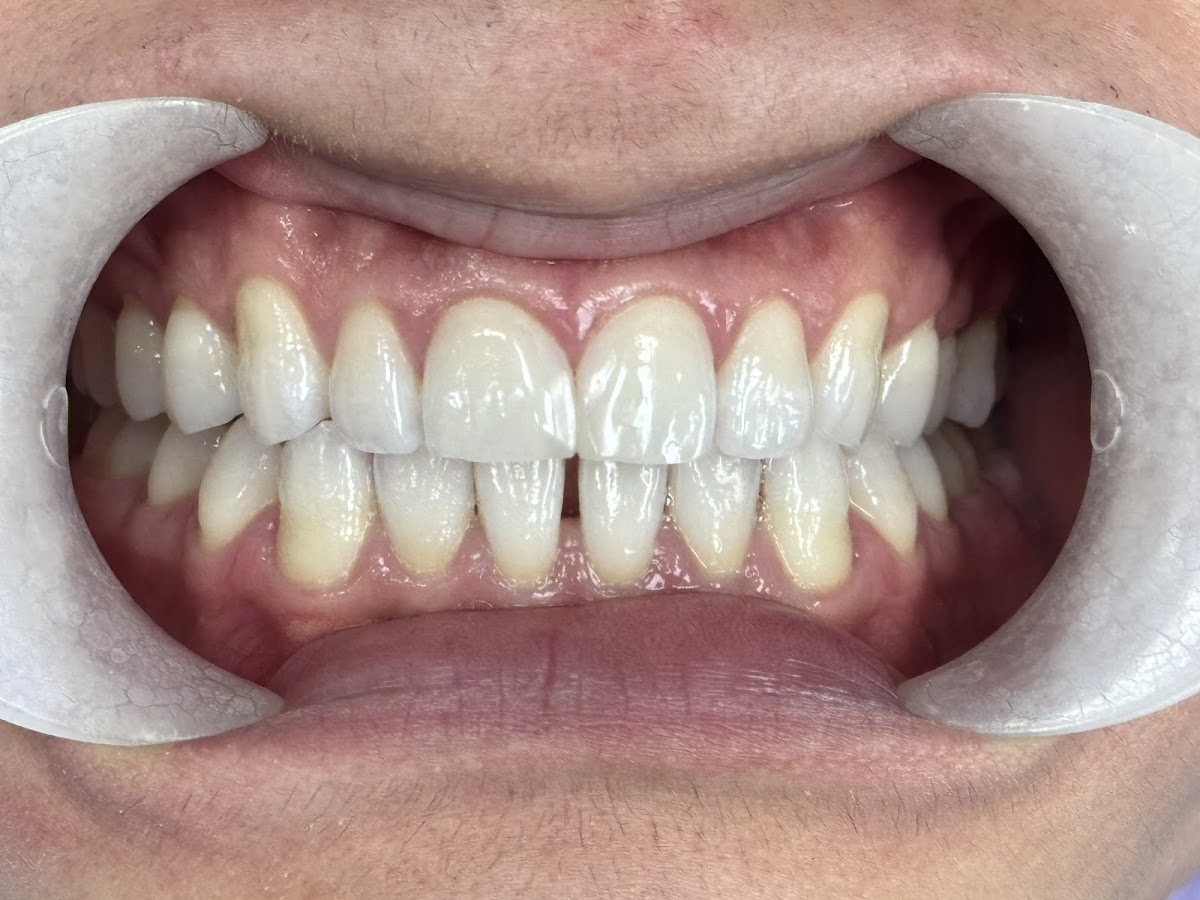 Prime Dental Centre dental clinic in Surrey - Photo 1