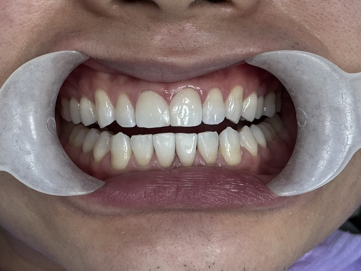 Prime Dental Centre dental clinic in Surrey - Photo 3