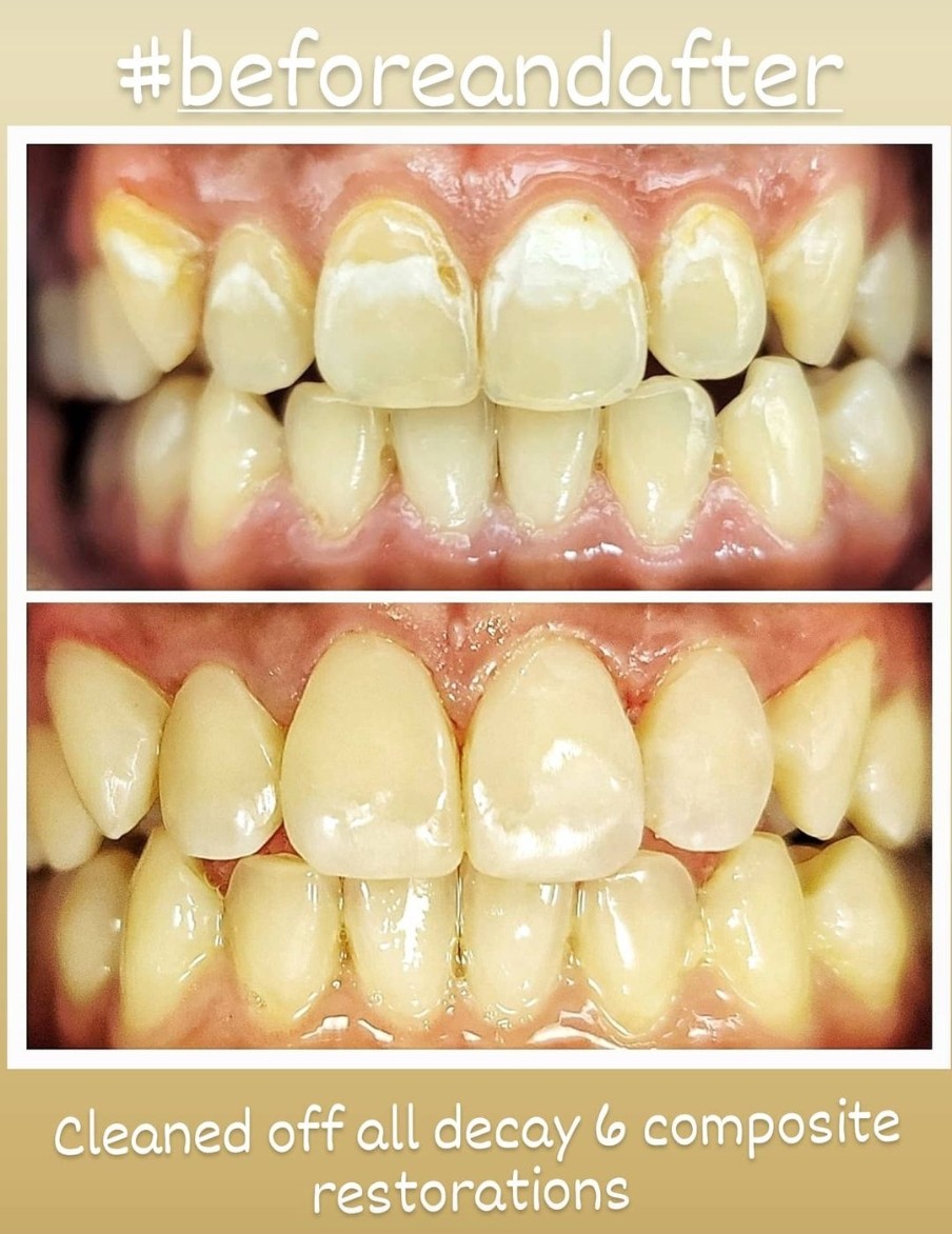 Prime Dental Centre dental clinic in Surrey - Photo 4