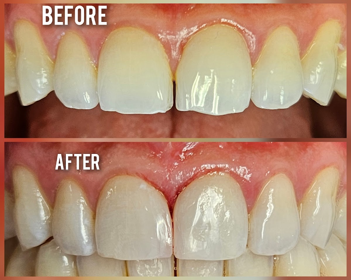 Prime Dental Centre dental clinic in Surrey - Photo 5