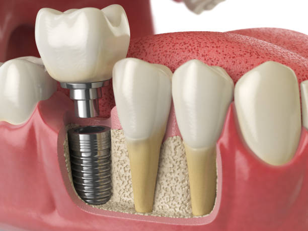 Bowmanville Smiles Dental Centre dental clinic in Clarington - Photo 4