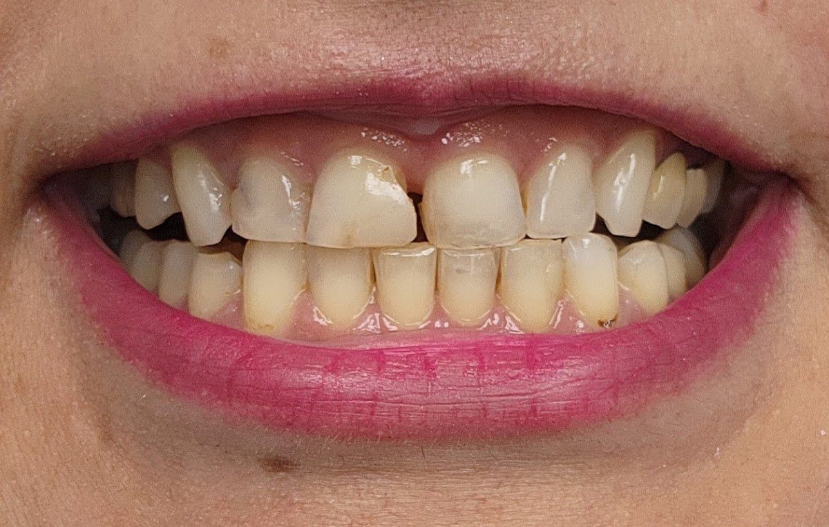 Maple Dental Health dental clinic in Vaughan - Photo 4