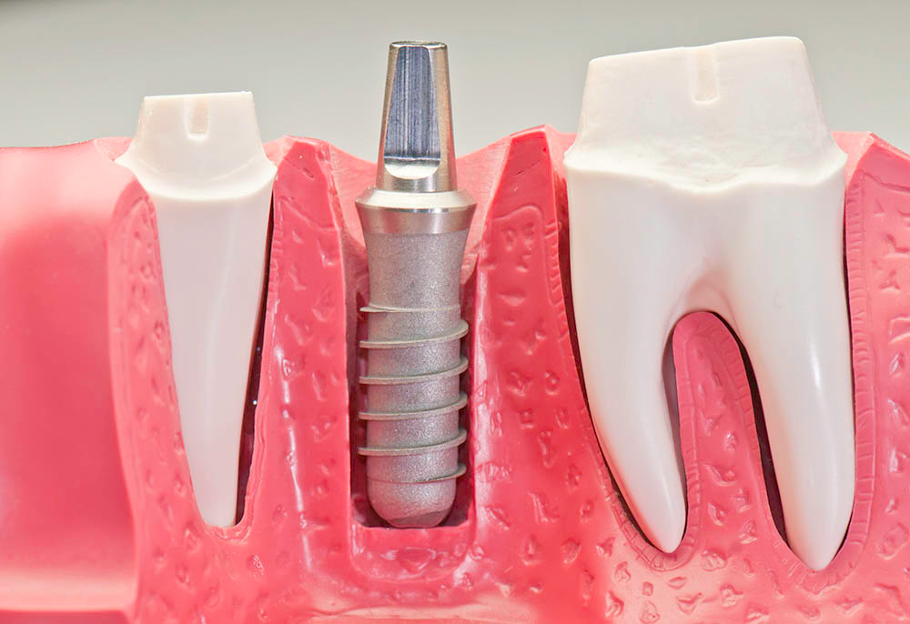 Dr. El Deeb Family Dental Care dental clinic in Ottawa - Photo 3