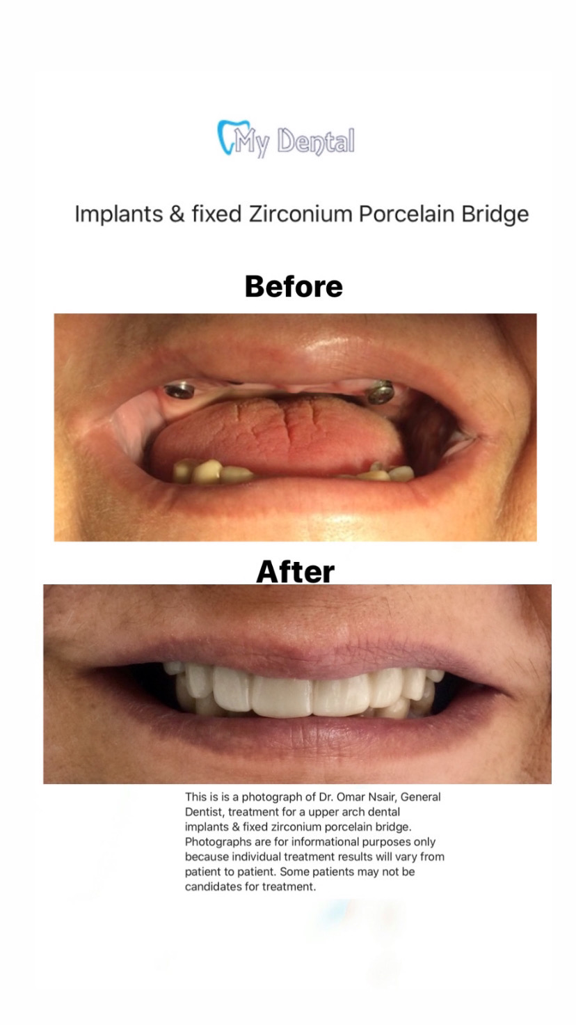 My Dental dental clinic in Edmonton - Photo 10