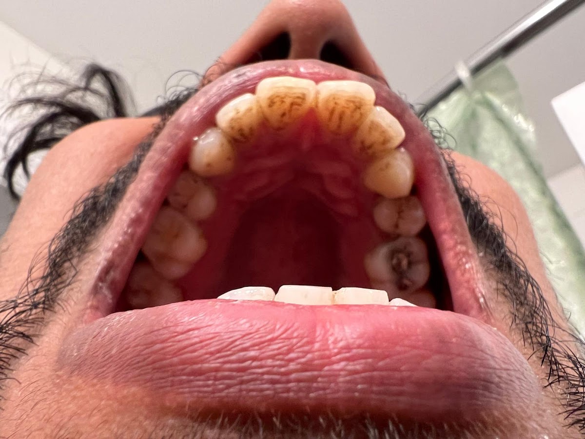 Hillside Dental Care dental clinic in Cambridge - Photo 7