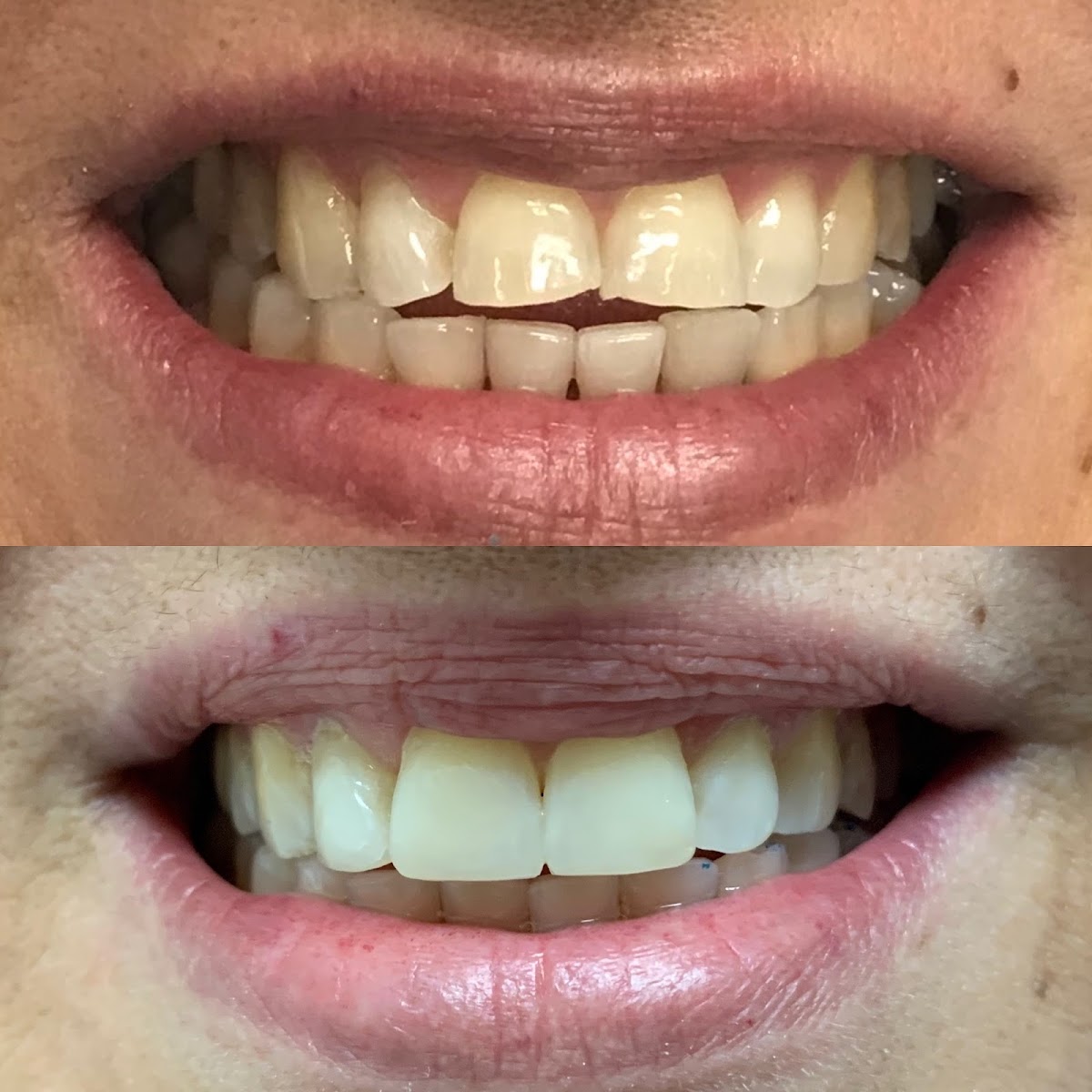 Dentistry on the Q dental clinic in Etobicoke - Photo 6