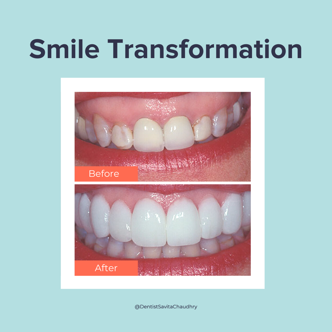 Dr. Savita Chaudhry dental clinic in Etobicoke - Photo 9