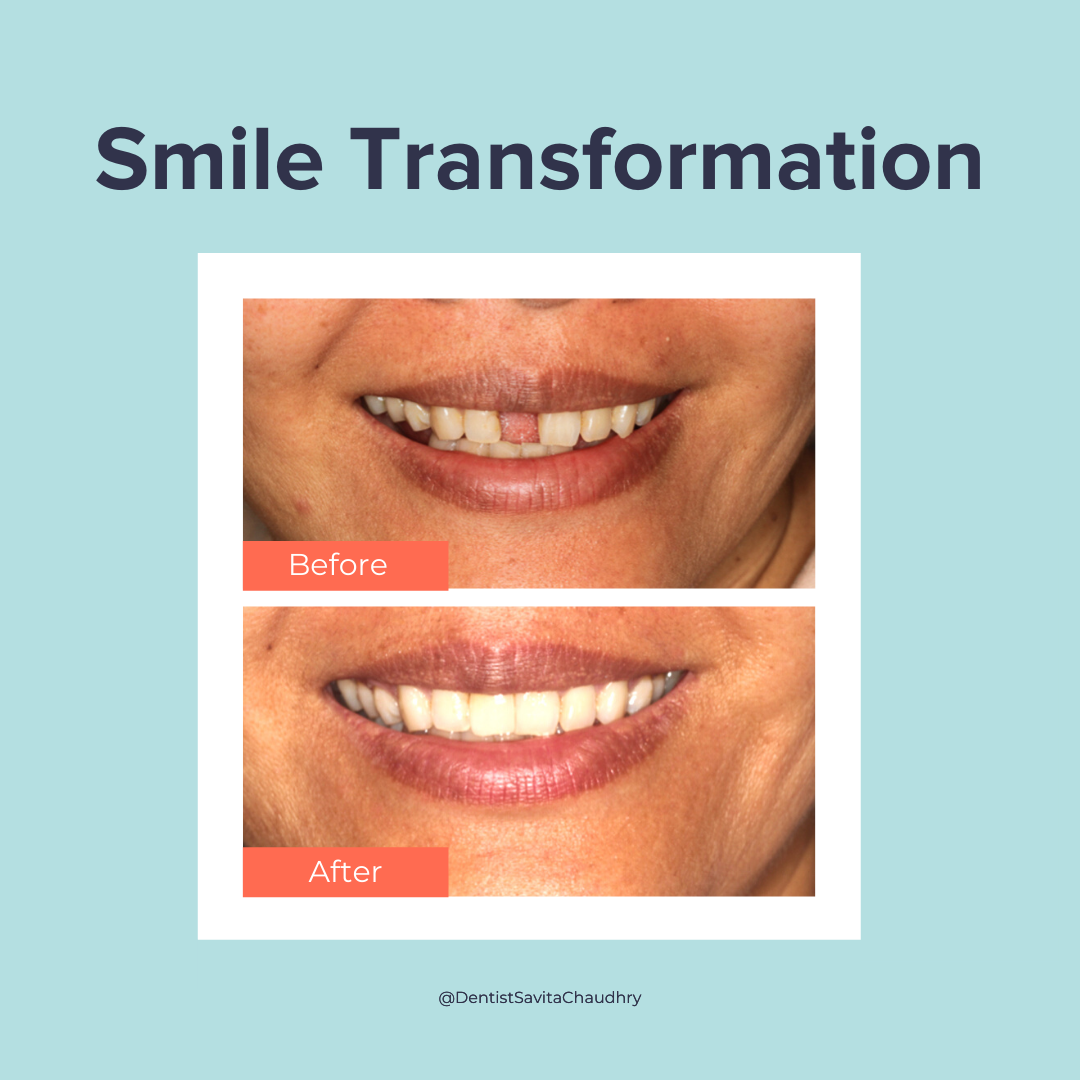 Dr. Savita Chaudhry dental clinic in Etobicoke - Photo 10