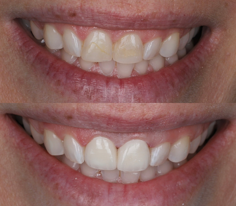 Lily Dental - Hamilton dental clinic in Hamilton - Photo 4
