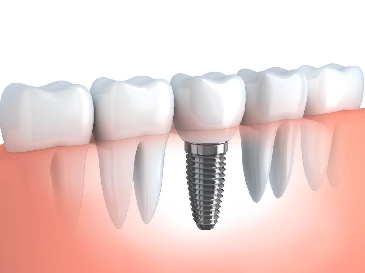 Li Family Dental dental clinic in Etobicoke - Photo 3