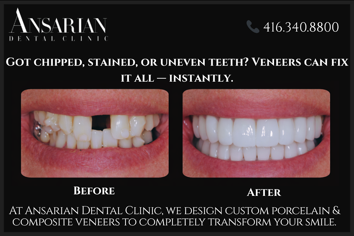 Ansarian Dental Clinic dental clinic in Old Toronto - Photo 9