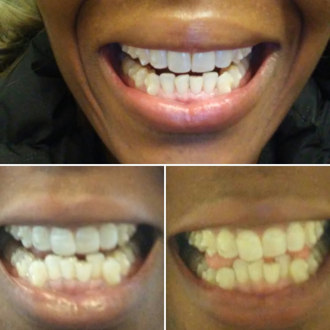 Altima Dental Centre at First Canadian Place dental clinic in Old Toronto - Photo 3