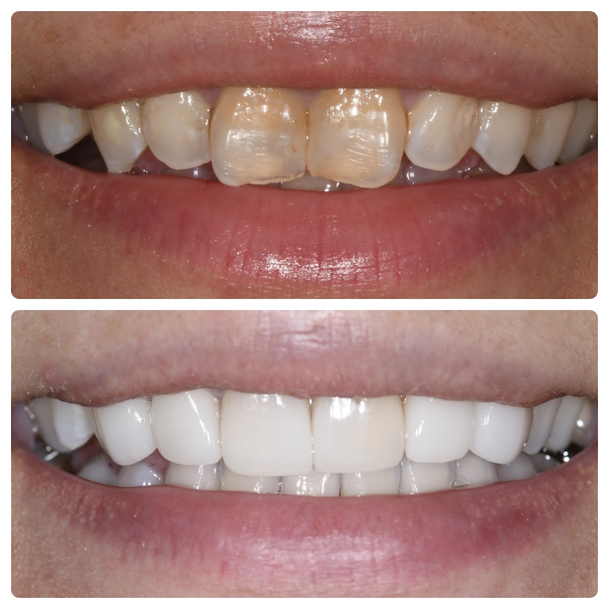 Market Dental Centre | Old Town Toronto and St Lawrence Market Area dental clinic in Old Toronto - Photo 1