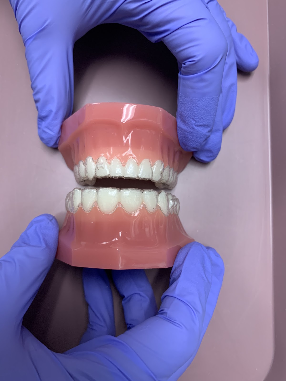 Healthy Smile Dental Hygiene - Dentist Brampton dental clinic in Brampton - Photo 4