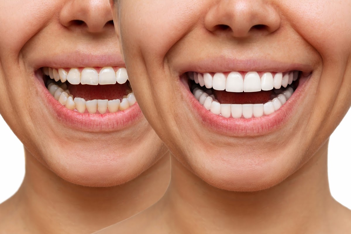 London Dental House dental clinic in London - Photo 1
