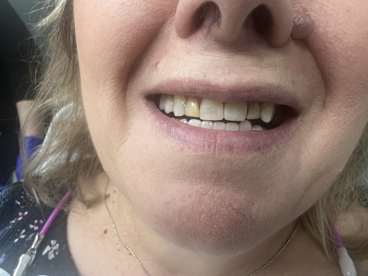 Dentistry at Sullivan dental clinic in Scarborough - Photo 6
