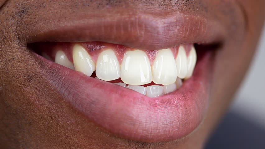 VS Dental By Everbright Smiles dental clinic in Scarborough - Photo 3