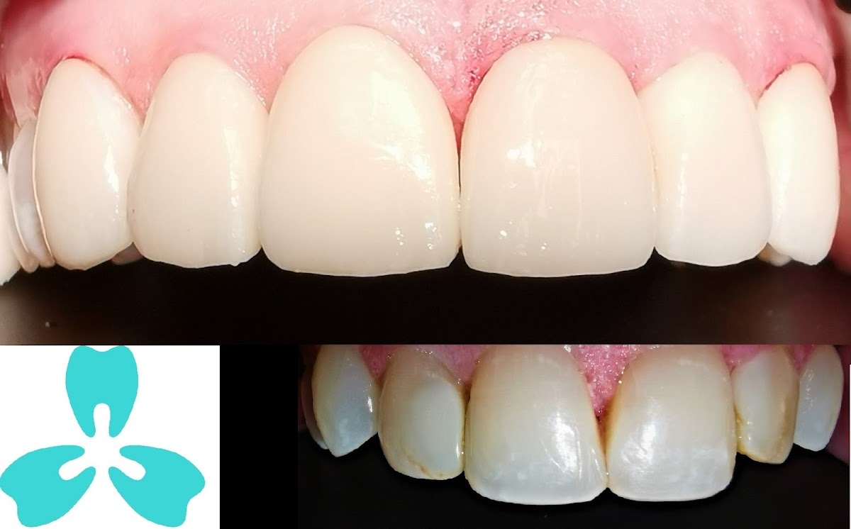 PleasantView Family Dental - Dr. Ross Tam Dr. Michael Chan Dr. Clement Lung dental clinic in Scarborough - Photo 3