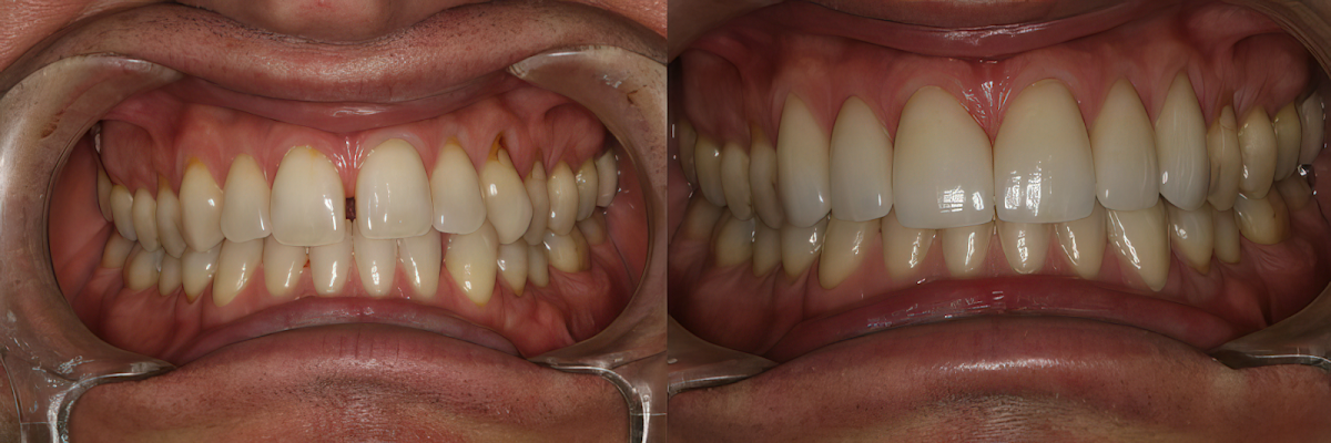 Smile Montreal dental clinic in Westmount - Photo 1