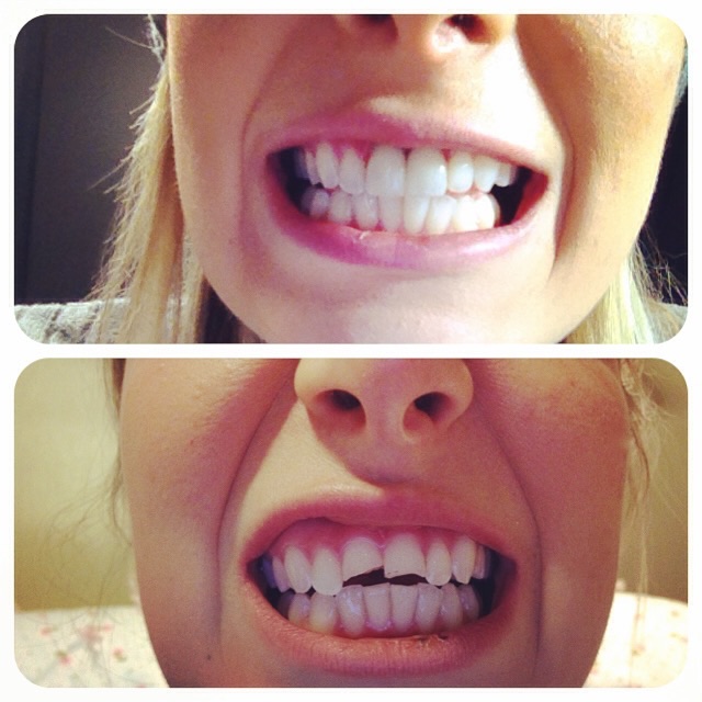 Smile Dental Centre dental clinic in London - Photo 10