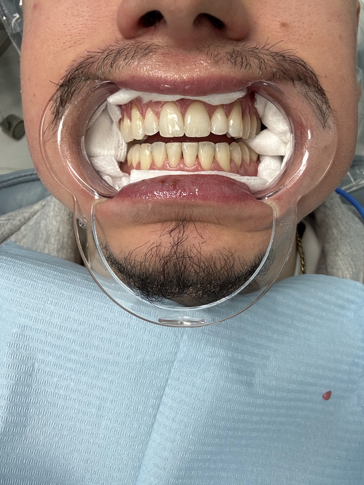 Destiny Dental dental clinic in Mississauga - Photo 4