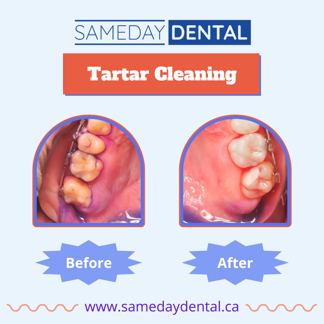 SAMEDAY DENTAL Hamilton - General, Family, Cosmetic & Emergency Dentist dental clinic in Hamilton - Photo 3