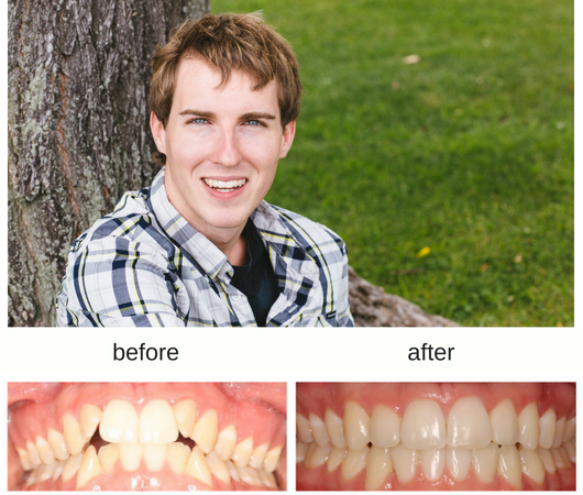 Hometown Orthodontics dental clinic in Mississauga - Photo 6