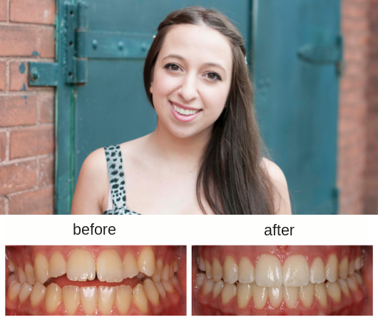 Hometown Orthodontics dental clinic in Mississauga - Photo 7