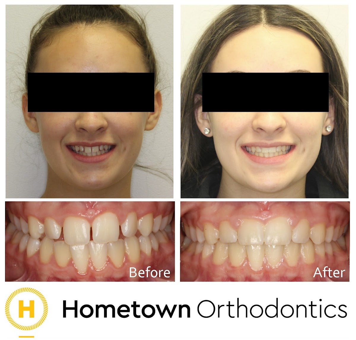 Hometown Orthodontics dental clinic in Mississauga - Photo 9
