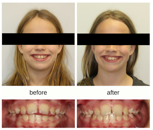 Hometown Orthodontics dental clinic in Mississauga - Photo 10