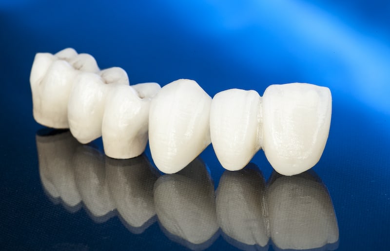 Dentistry at The Grove dental clinic in Burlington - Photo 6