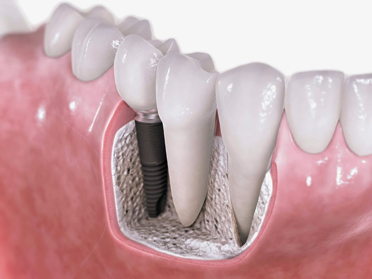 Marketplace Dentistry dental clinic in Vaughan - Photo 8
