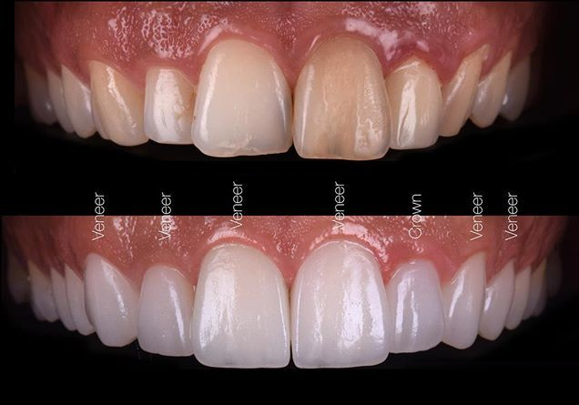 The Dental Smile Centre dental clinic in Bolton - Photo 6