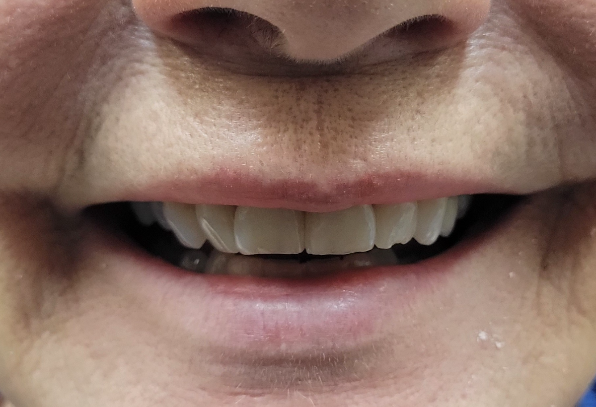 The Dental Smile Centre dental clinic in Bolton - Photo 10
