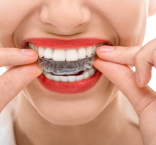 Kennedy North Dentistry - Caledon dental clinic in Caledon Village - Photo 1