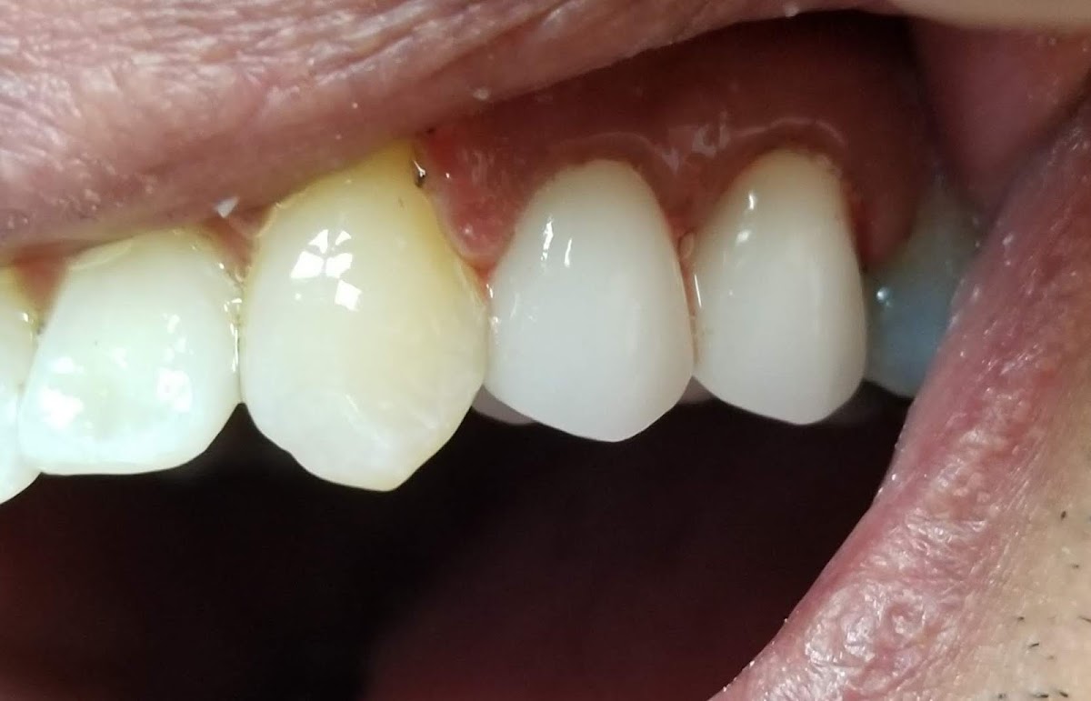 Hummingbird Dental Clinic | Dental Care in Richmond Hill dental clinic in Richmond Hill - Photo 5