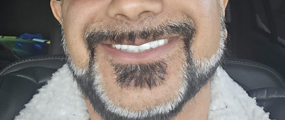 Dentistry In Springdale dental clinic in Brampton - Photo 7
