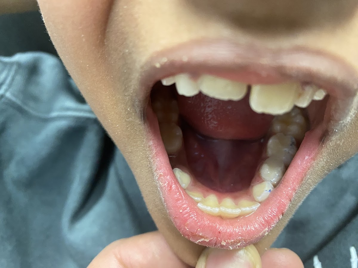 Springdale Family Dental dental clinic in Brampton - Photo 5