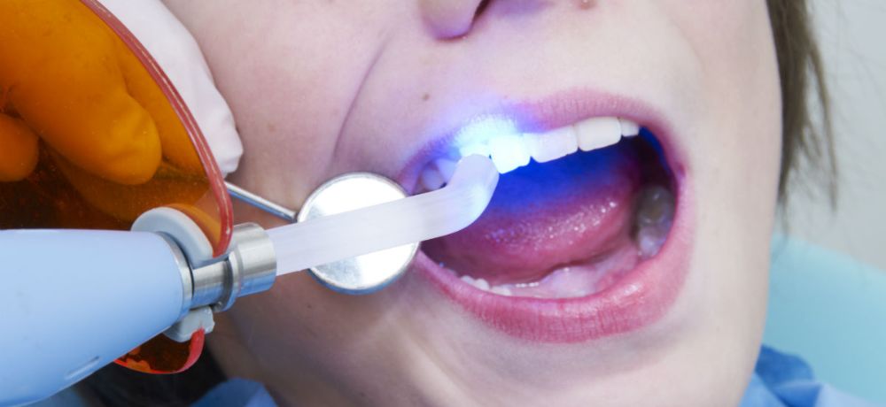 Mayfield Dental Clinic dental clinic in Brampton - Photo 7