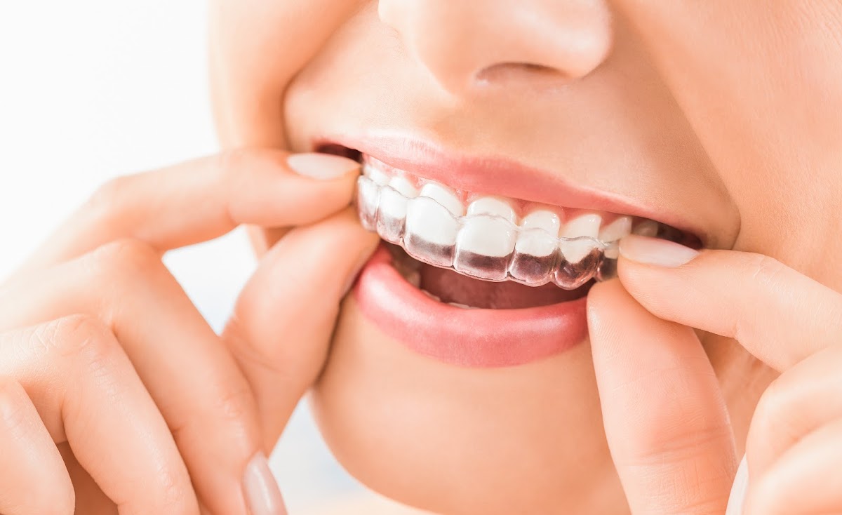 Polaris Dental dental clinic in Brampton - Photo 1