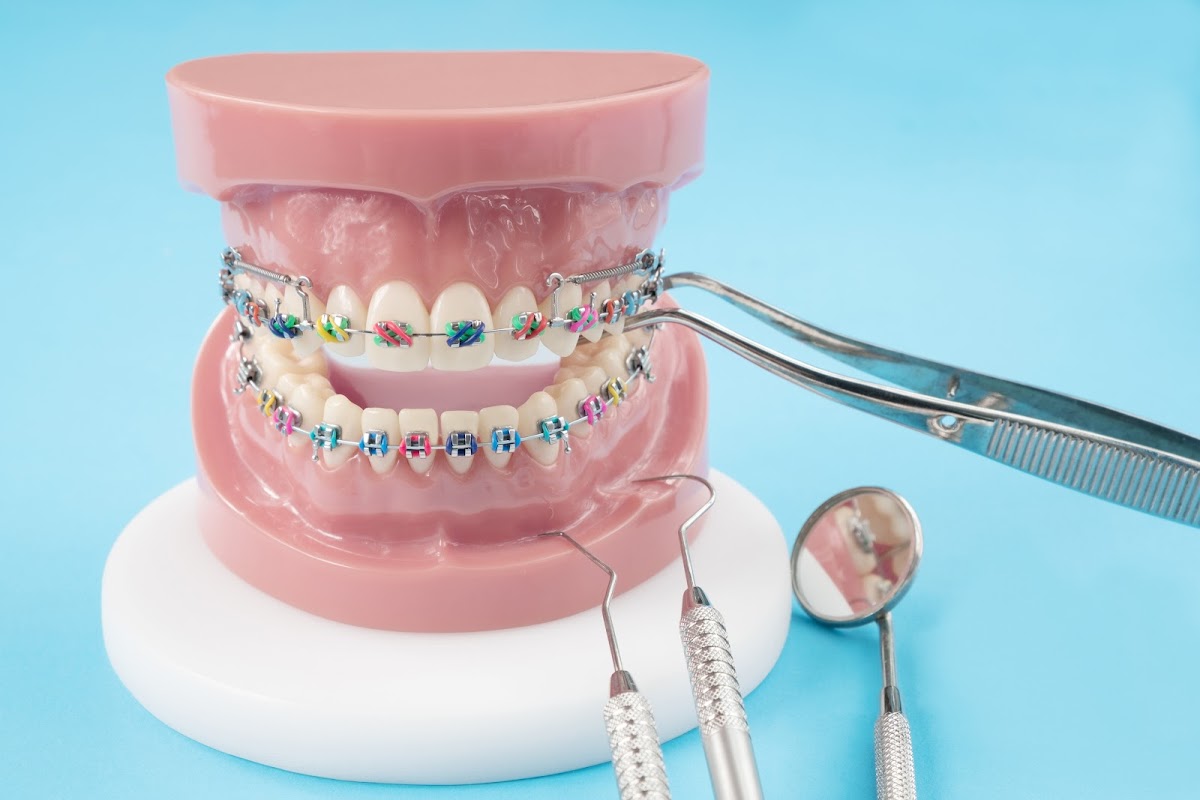 Polaris Dental dental clinic in Brampton - Photo 6
