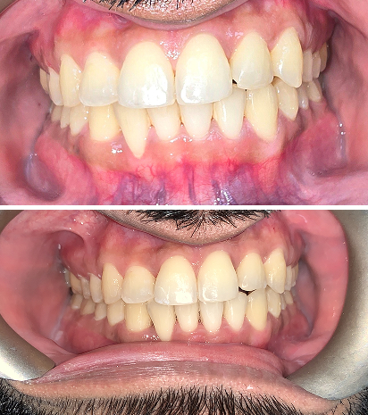 Align Dental Smiles - Brampton dental clinic in Brampton - Photo 2