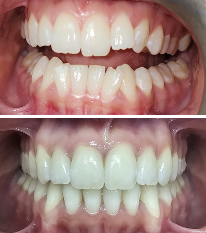 Align Dental Smiles - Brampton dental clinic in Brampton - Photo 8