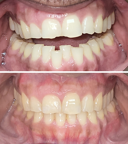 Align Dental Smiles - Brampton dental clinic in Brampton - Photo 9
