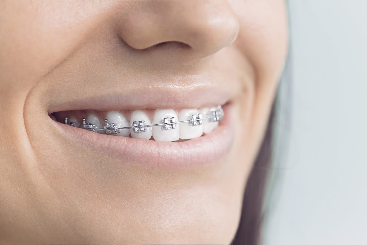 Dr Sandhu dental clinic in Brampton - Photo 1