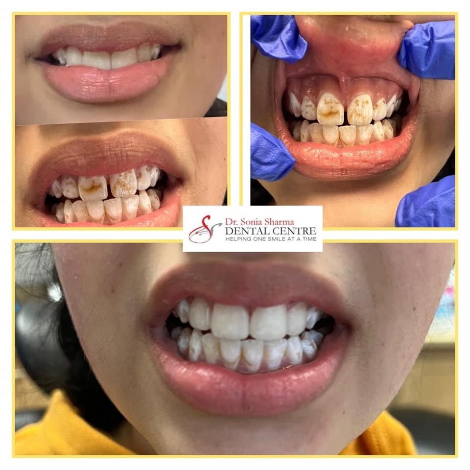 Dr. Sonia Sharma dental clinic in Brampton - Photo 1